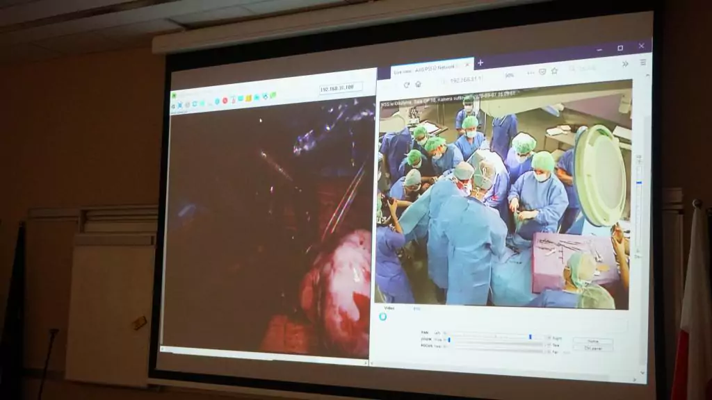 Pierwszy poród francuski w Polsce, Olsztyn 2020 - blog helloskarbie.pl