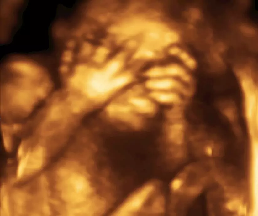 USG 3D płodu - blog helloskarbie.pl